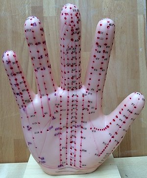 Adjunct & Non-Invasive Options. acupuncture witney oxfordshire hand model
